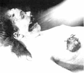 Autopsy table